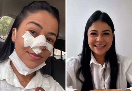 Jovem com leucemia usa redes sociais para compartilhar tratamento e fortalecer fé