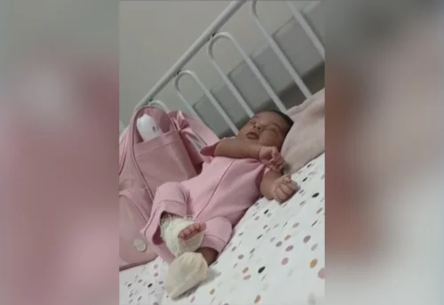 Família denuncia erro em aplicação de medicamento que causou necrose em bebê de 15 dias em Palmas