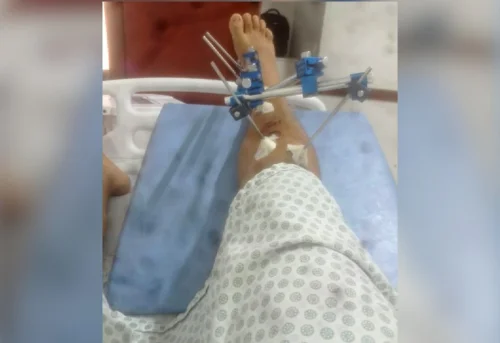 Jovem denuncia agressão de PMs dentro de hospital em Formoso do Araguaia, TO