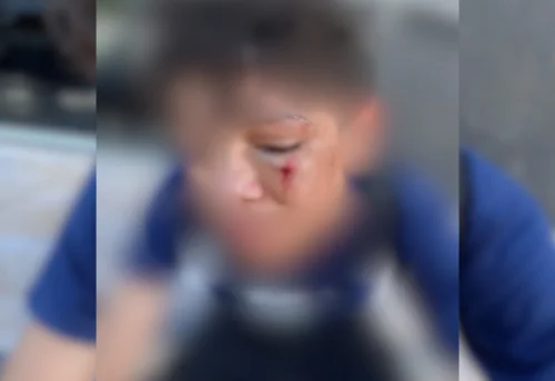 Família denuncia agressão a aluno de 14 anos após bullying em escola do Tocantins